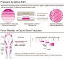 Bruise, the Injury Detection Suit