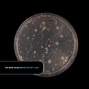 Bacteria found in cars