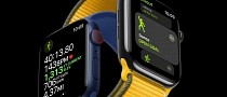 Apple Watch Saves the Life of Driver Knocked Unconscious After Crash