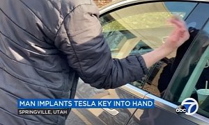 Cybernetics Enthusiast Gets Arm Implant to Open His Tesla With Just a Wave