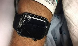 Cyclist Crashes at 20mph and Blacks Out, Is Saved by His Apple Watch