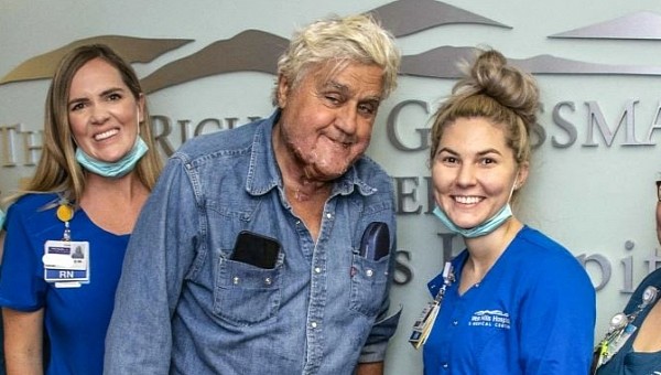 Jay Leno poses for the first picture since suffering 3rd degree burns in a car fire inside his Burbank garage