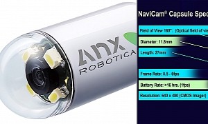 Magnet-Driven Video Camera Capsule Can Move Inside Your Body With Purpose