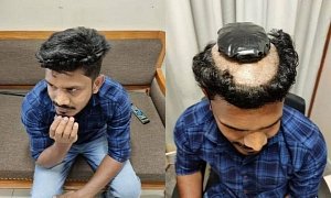 Smuggler Caught With 2.49 Pounds of Gold Hidden Under His Wig