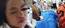 Woman Gets Eyeliner Pencil Stuck in Her Eye During Taxi Ride